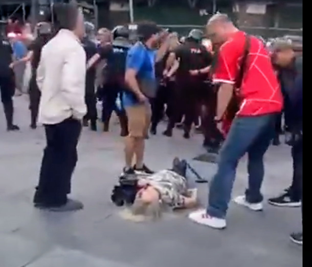 El Argentino Diario-Jubilada agredida por la policía y herida en marcha de jubilados.